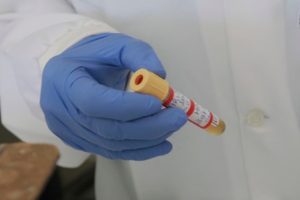 Confirmada a 3 morte por dengue em Araxá pag 04
